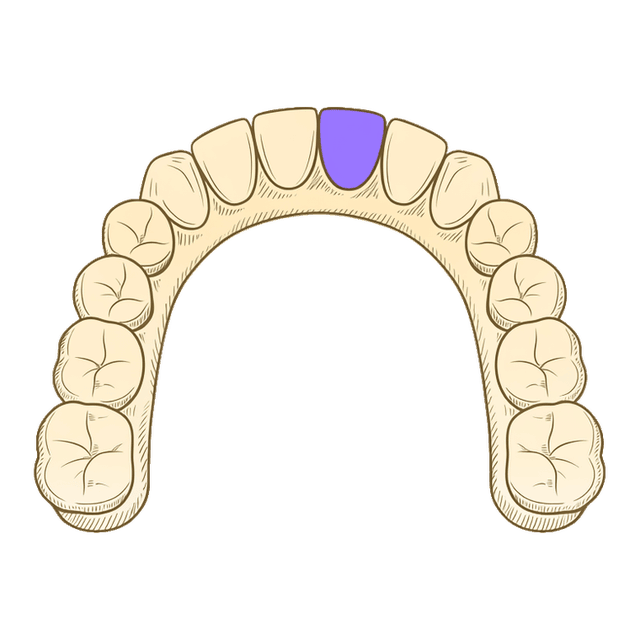 Line illustration of a full upper dental arch with one tooth highlighted